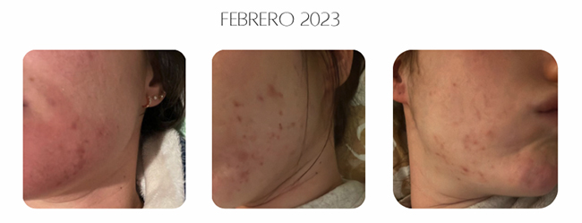 caro real miriam 1 caro real miriam 1